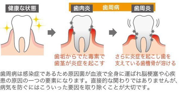 【コビー】プロポリス薬用歯磨き